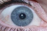 Irisdiagnose