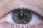 Irisdiagnose